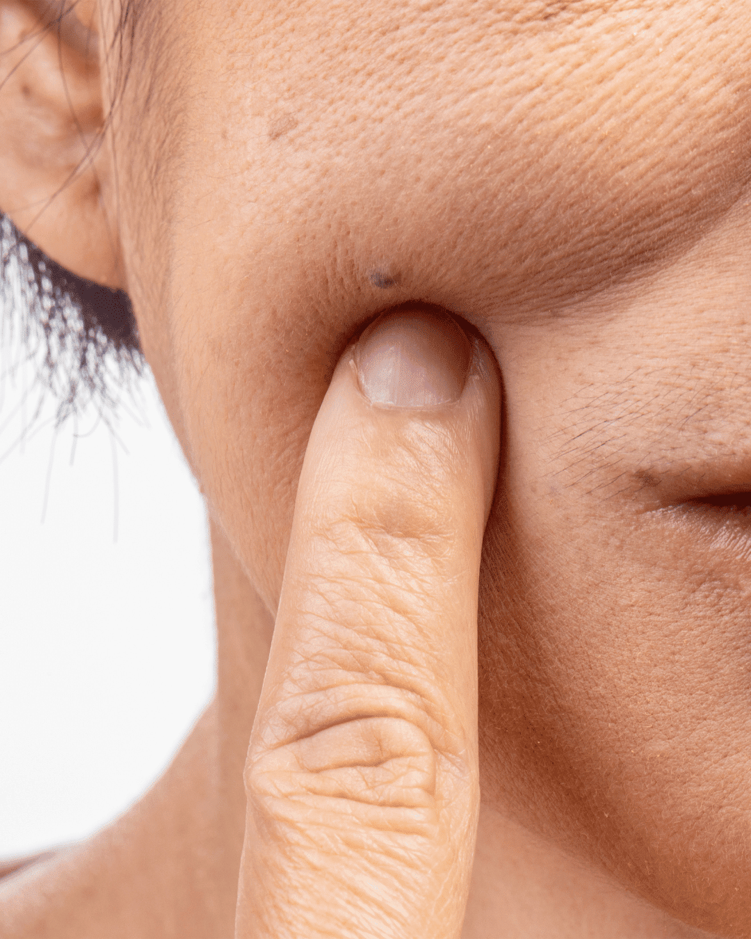 Anti Ageing