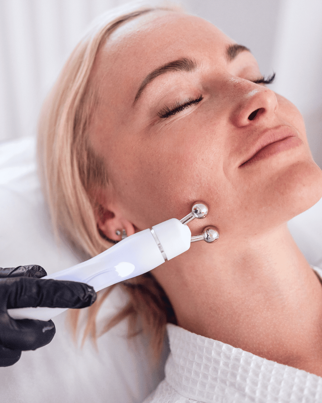 Microdermabrasion