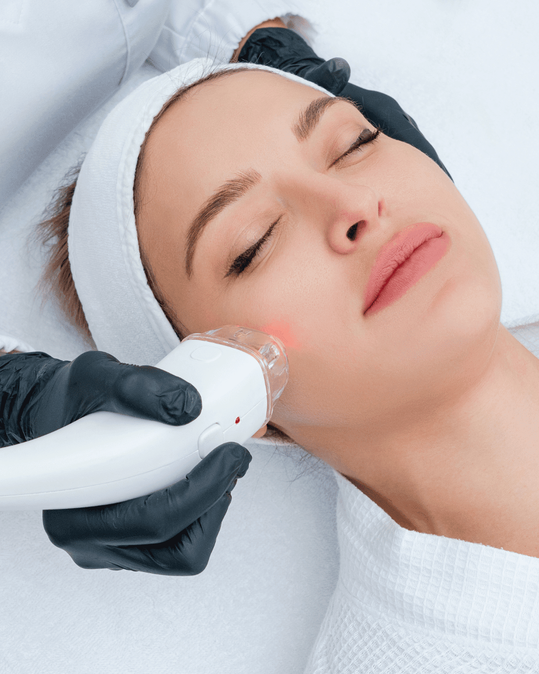 Laser Skin Rejuvenation