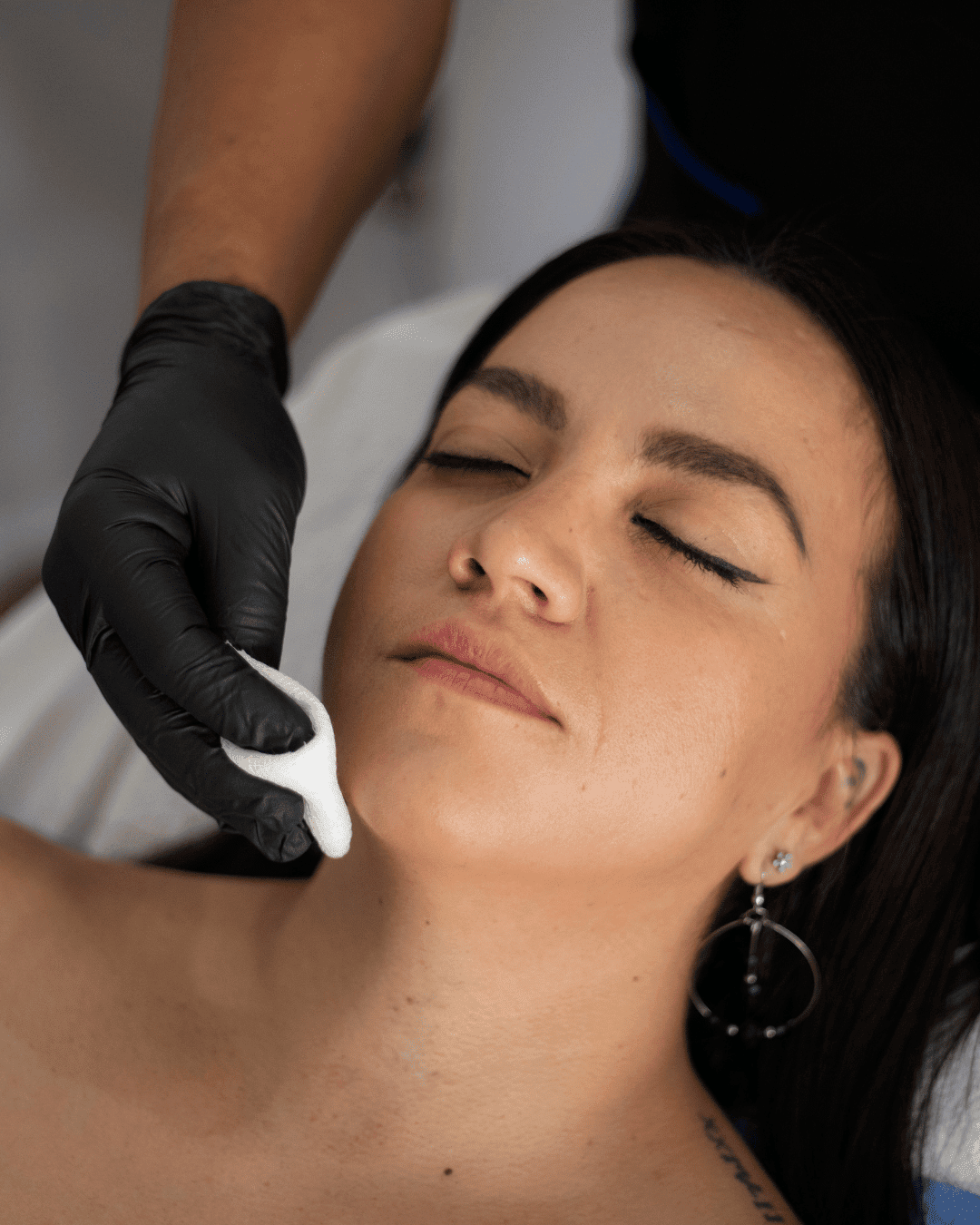 Microdermabrasion -lethia care