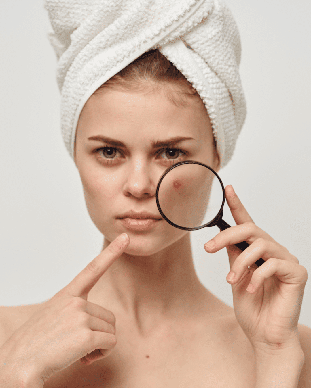 Acne Treatment Lethia care