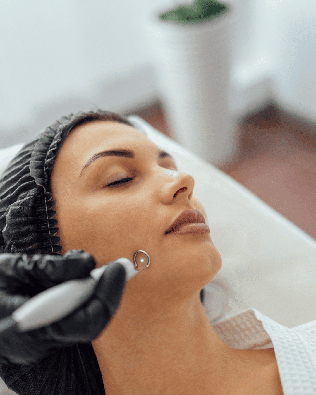 Pigmentation Removal