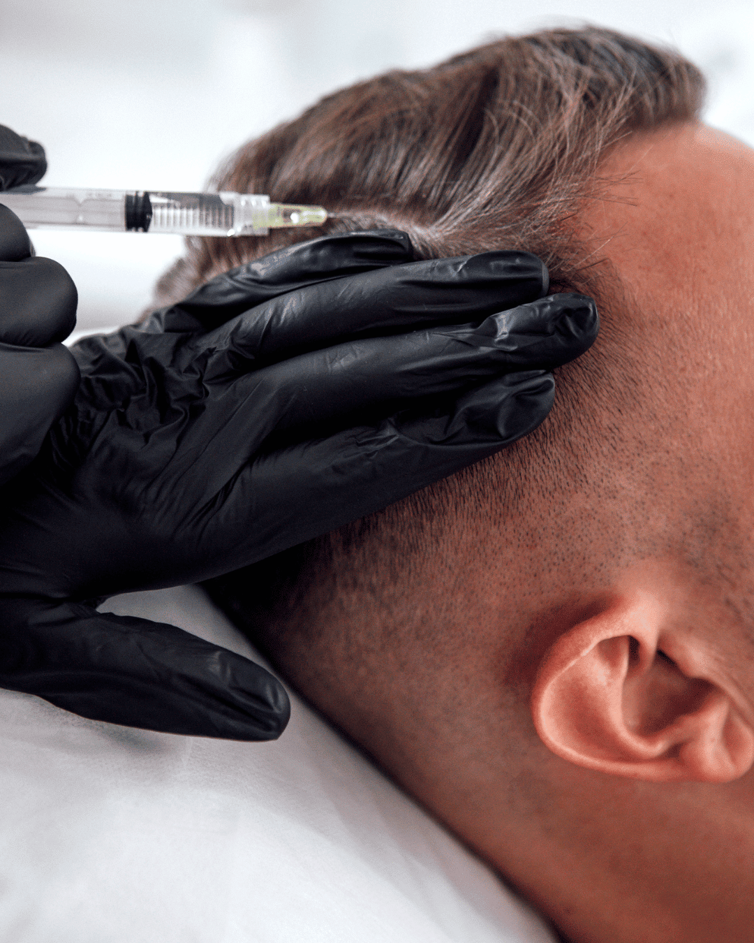 GFC (Growth Factor Concentrate) treatment